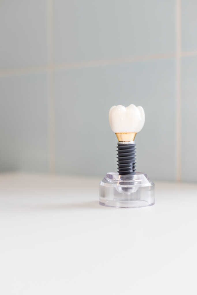 implantes dentales en santa eugenia